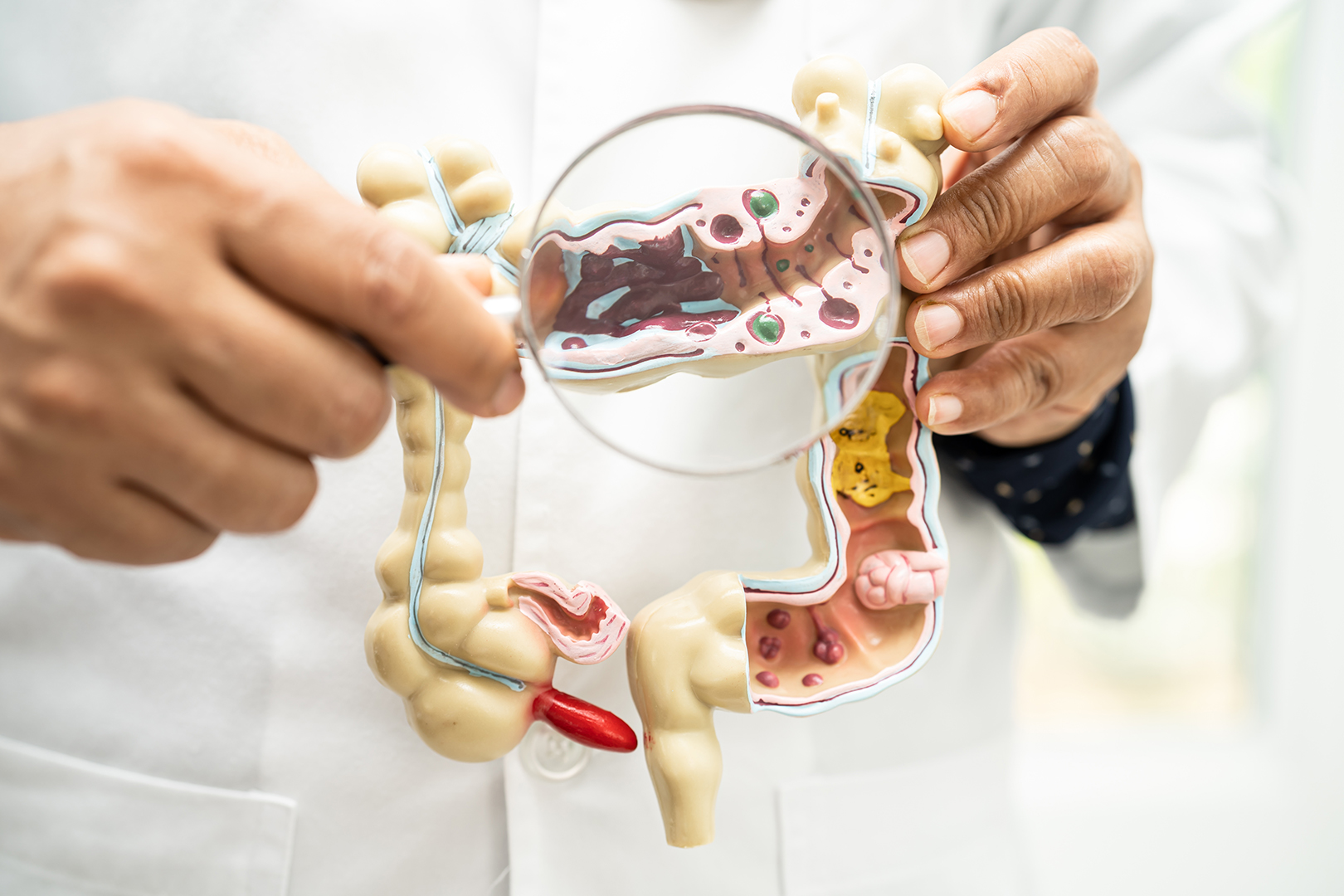 NICE Approves Five AI Tools to Spot Bowel Cancer Earlier - Dr Richard Dune - LearnPac Systems UK - NICE Approves Five AI Tools to Spot Bowel Cancer Earlier - Dr Richard Dune - LearnPac Systems UK -