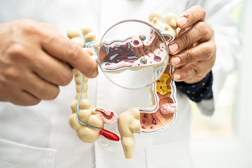 NICE Approves Five AI Tools to Spot Bowel Cancer Earlier - Dr Richard Dune - LearnPac Systems UK -